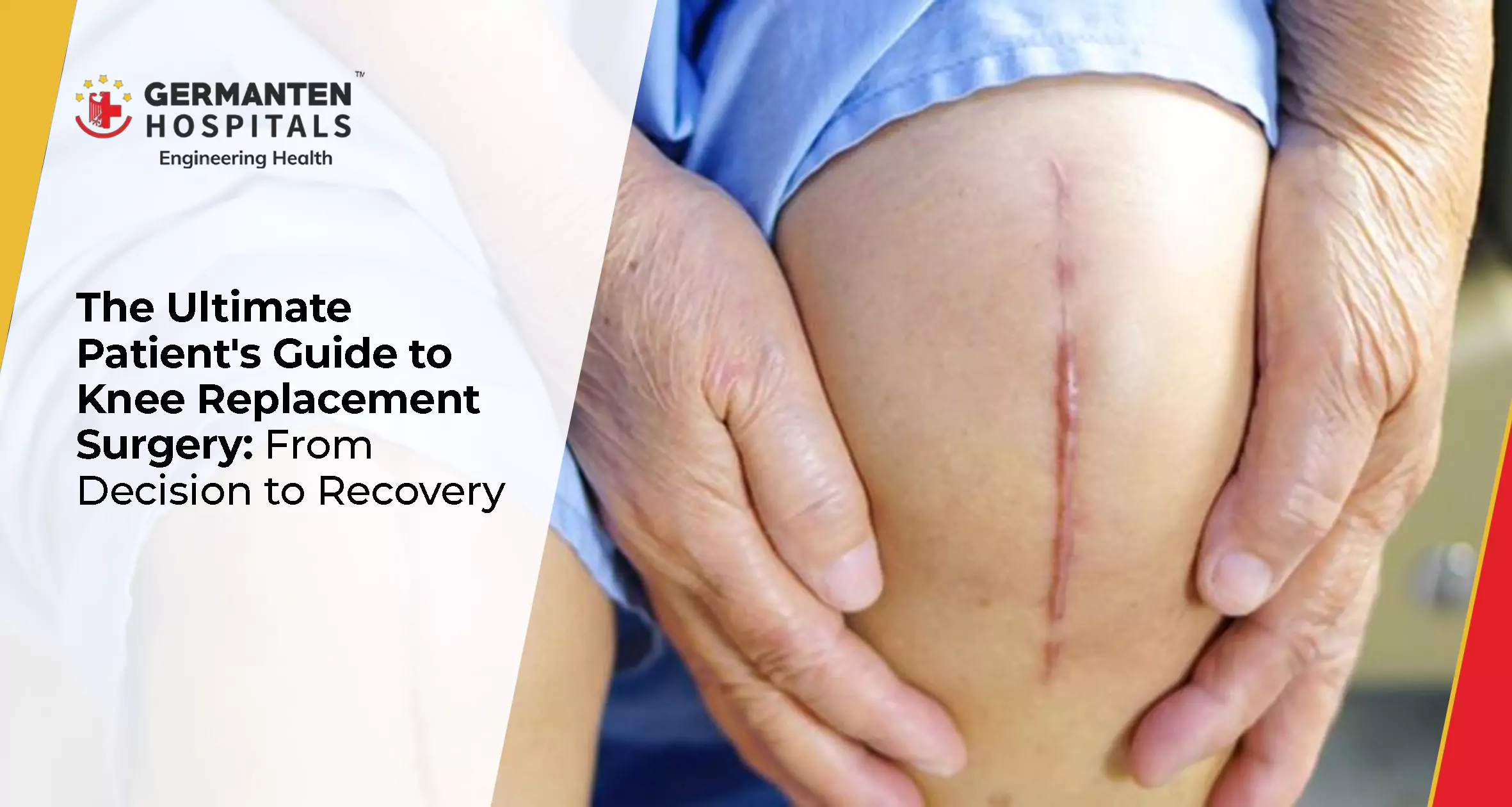 Knee Replacement