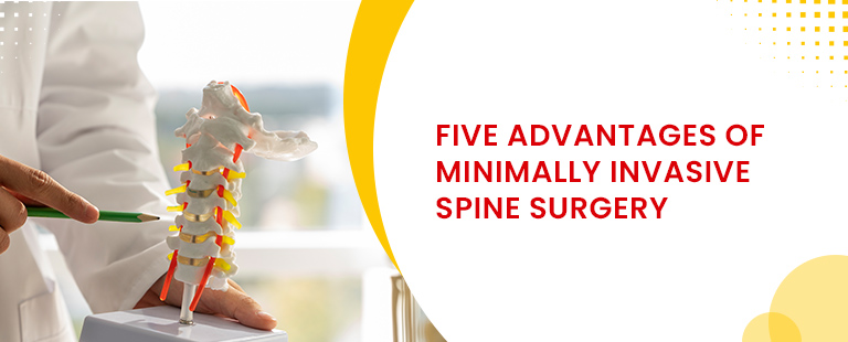 Five advantages of minimmaly invasive spine surgery