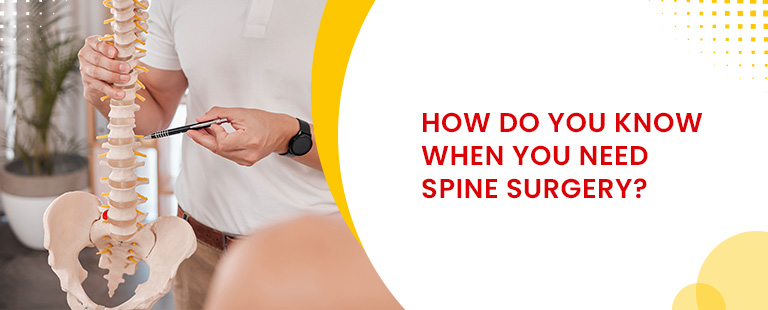 How do you know when you need spine surgery