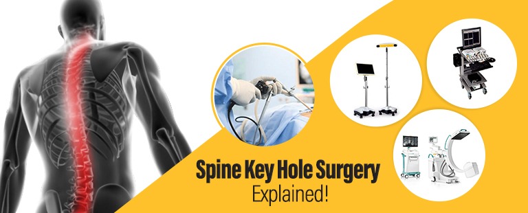 Spine keyhole surgery in hyderabad